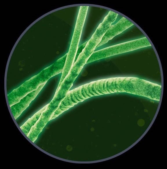 dyson-gen5detect-absolute-8